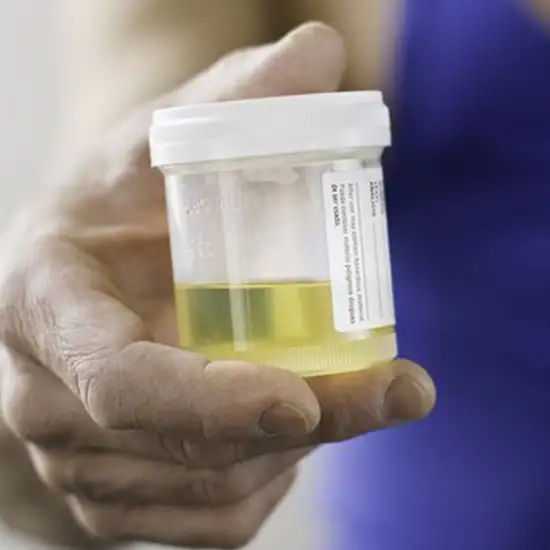 Serotonin 24 Hour Urine